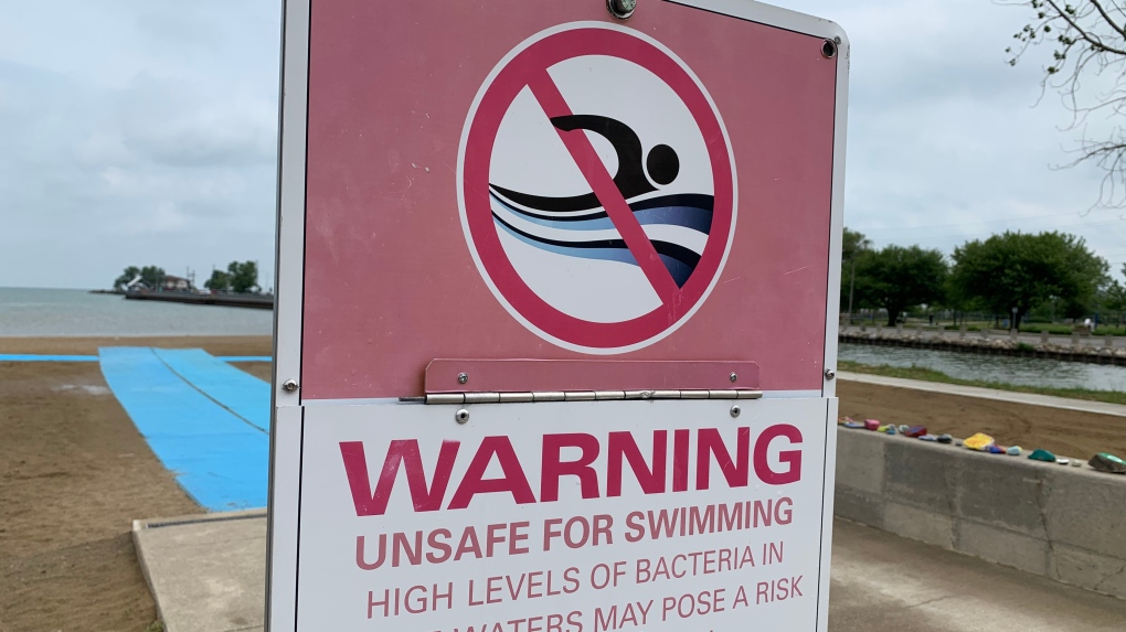 Water unsafe for swimming sign in Windsor, Ont. on Friday, June 18, 2021. (Chris Campbell/CTV Windsor)